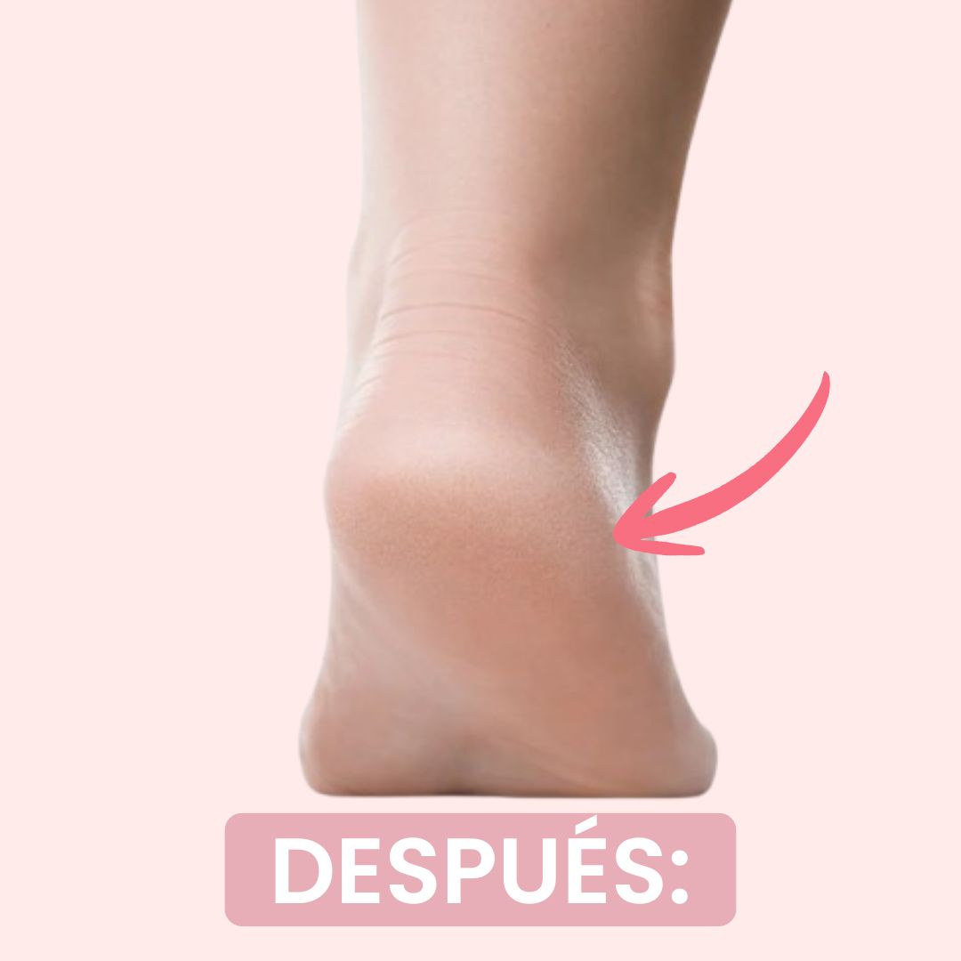 Después