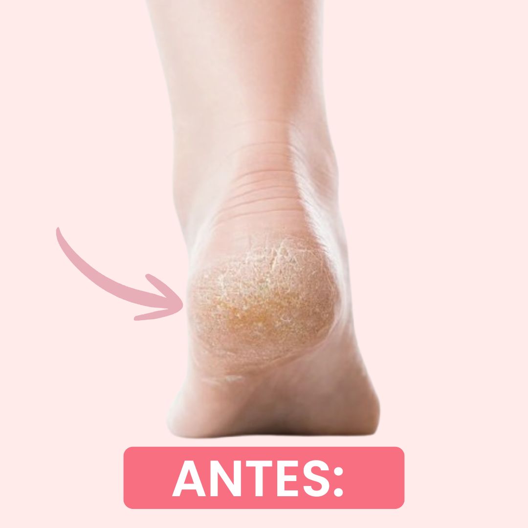 Antes