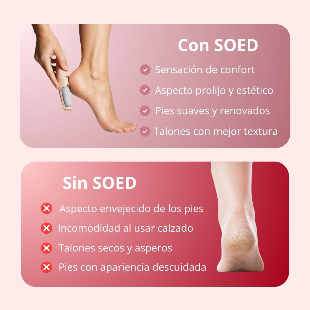 SOED™-Pies suaves y cuidados