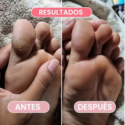 SOED™-Pies suaves y cuidados