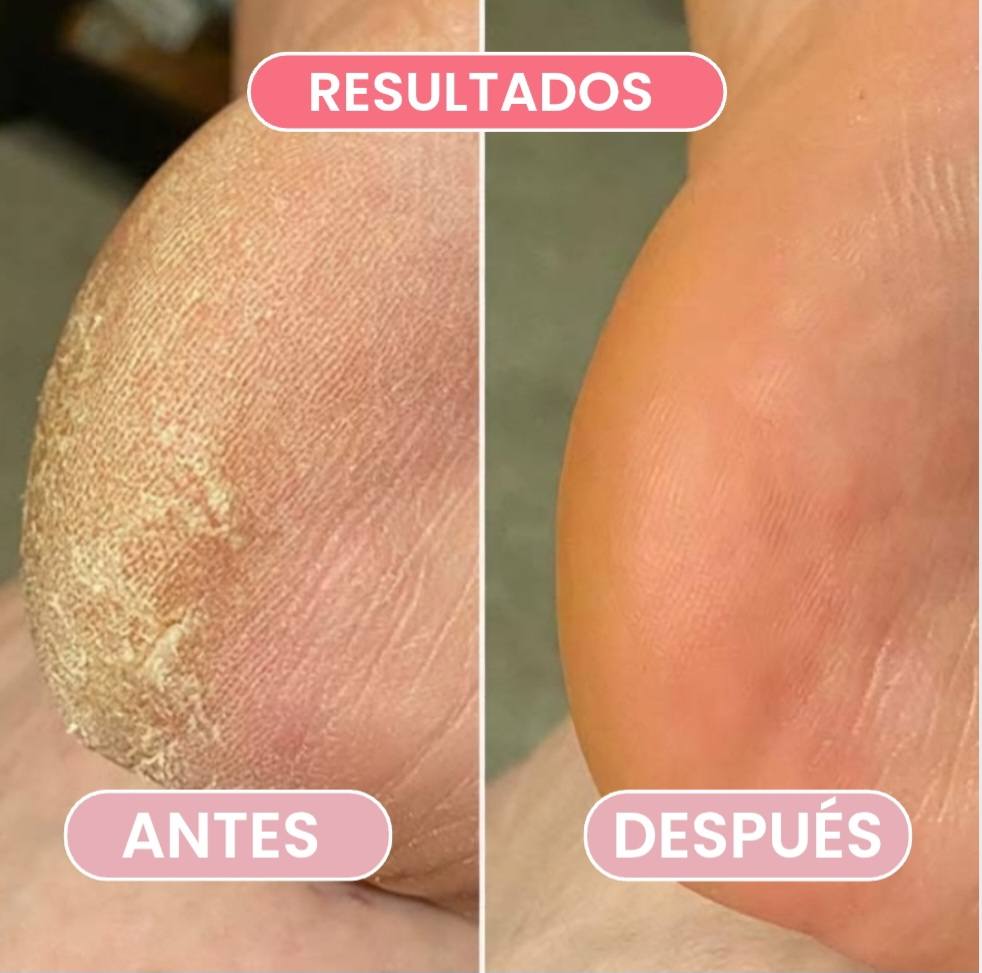 SOED™-Pies suaves y cuidados