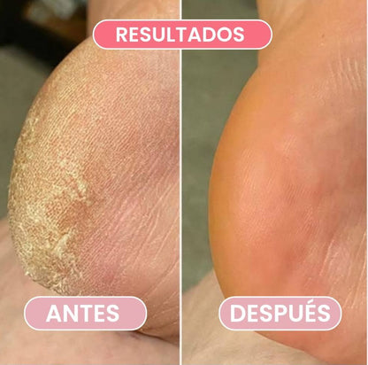 SOED™-Pies suaves y cuidados