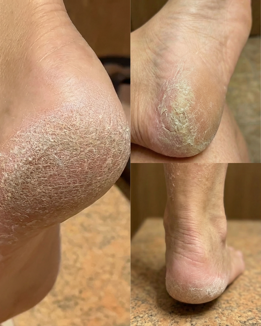 Me daba vergüenza mostrar mis pies